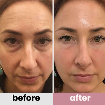 BOGO - Korean Retinol Under Eye Balm