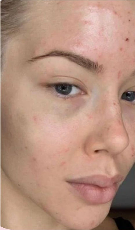 Rice Collagen Mask