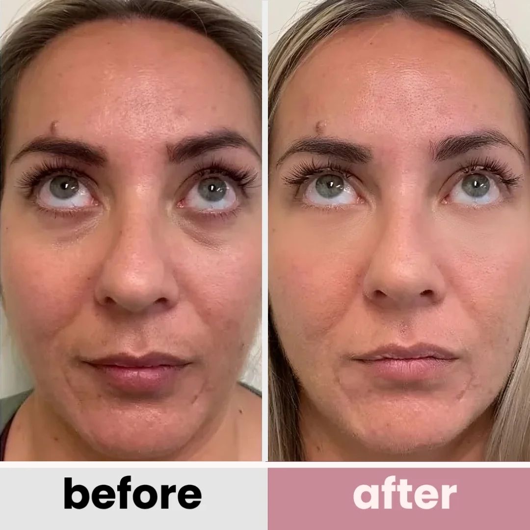 Korean Retinol Under Eye Balm