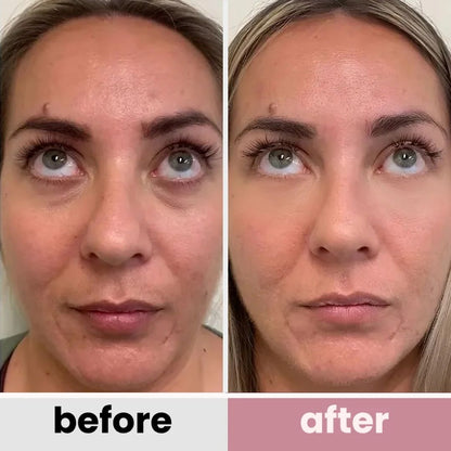 BOGO - Korean Retinol Under Eye Balm