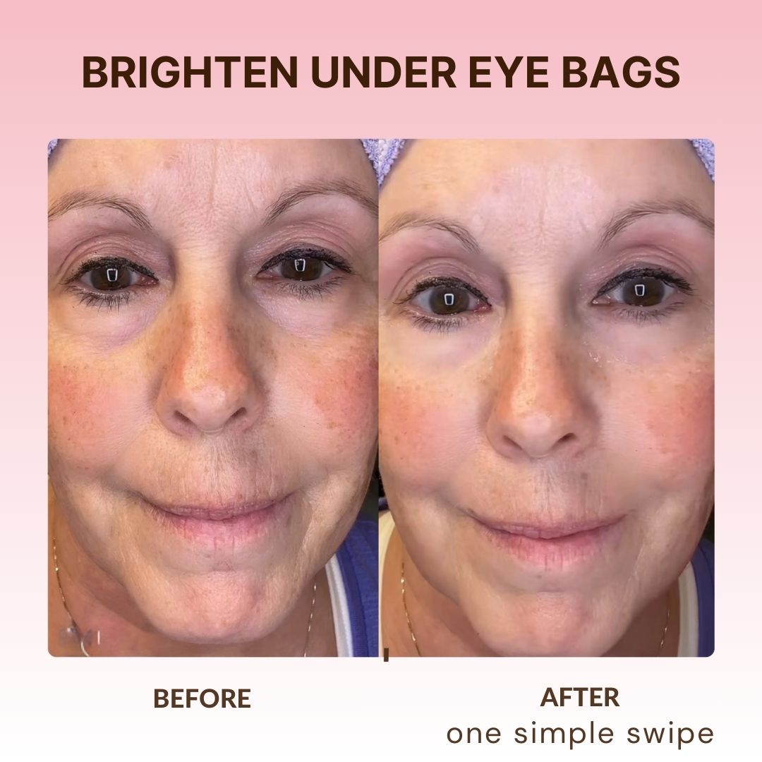 BOGO - Korean Retinol Under Eye Balm
