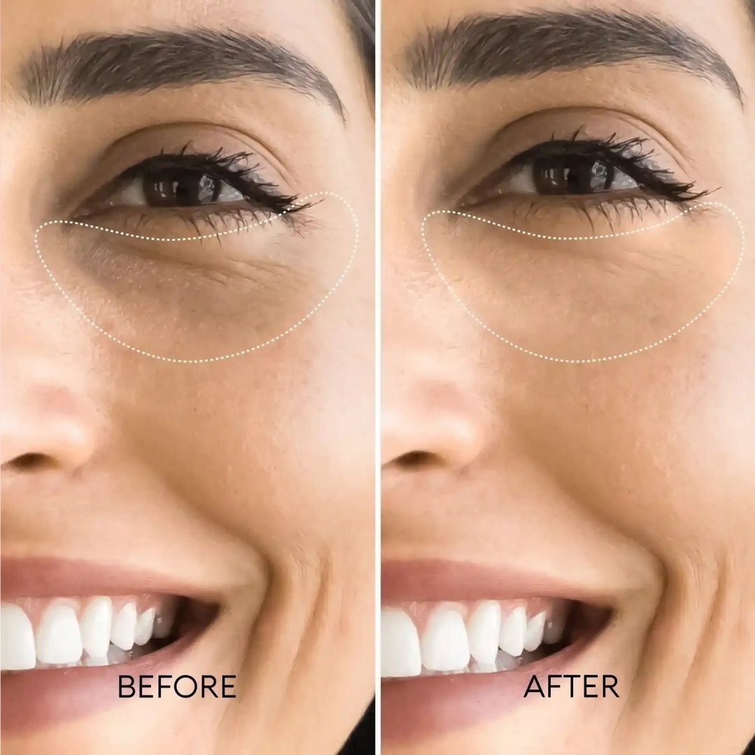 BOGO - Korean Retinol Under Eye Balm