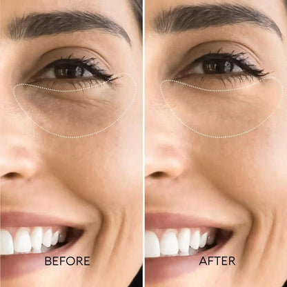 BOGO - Korean Retinol Under Eye Balm