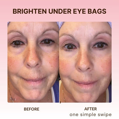 BodyLove - Instant Eye Lift