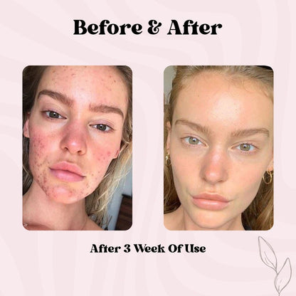 Deep Collagen Retinol Tension Boost-Up Mask