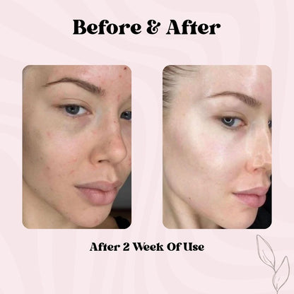 Deep Collagen Retinol Tension Boost-Up Mask