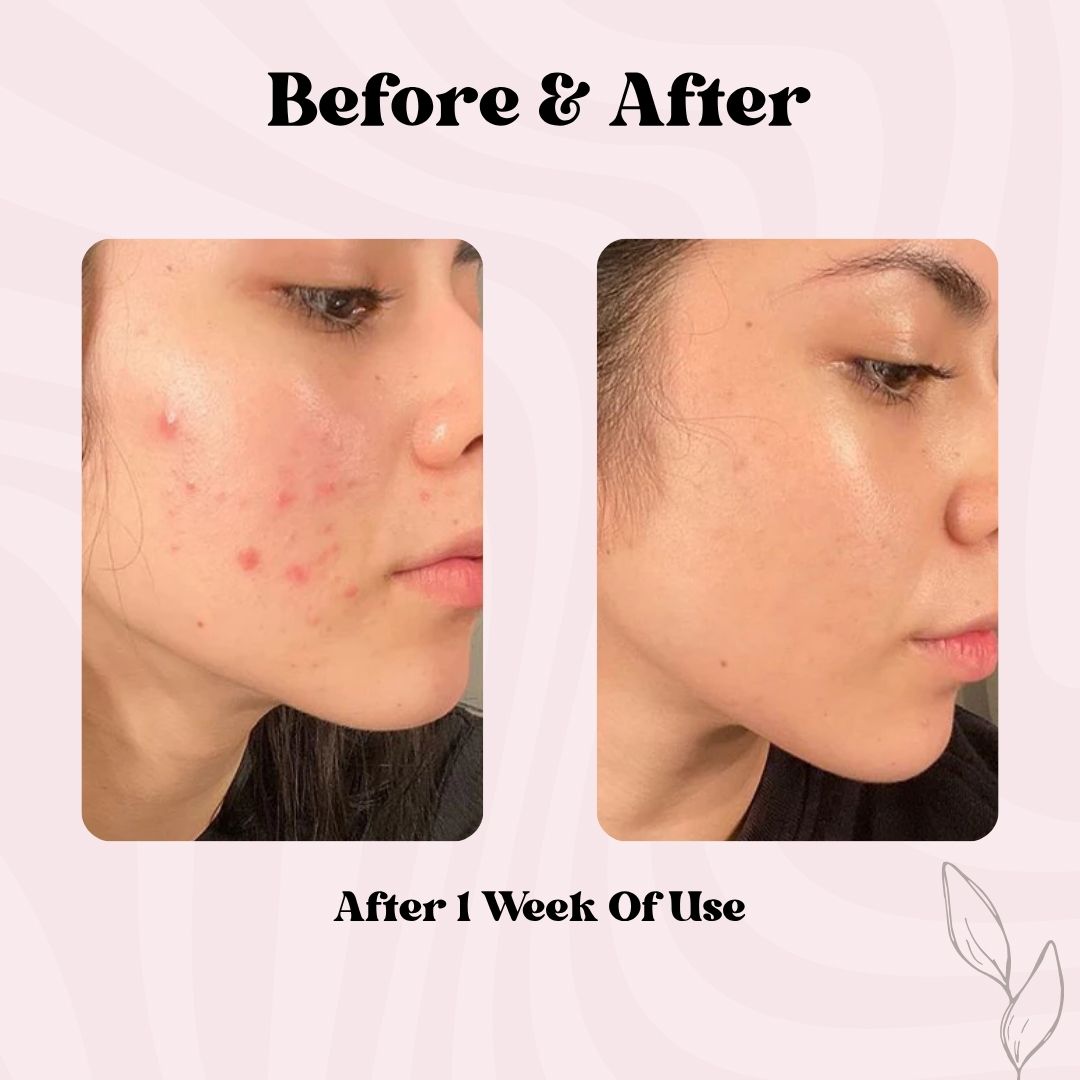 Korean PDRN Stick Glow Balm