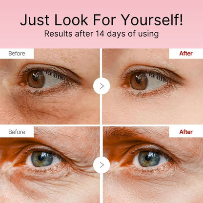 BOGO - Korean Retinol Under Eye Balm