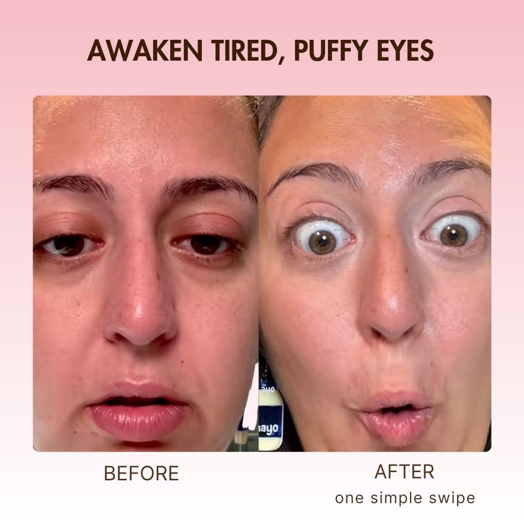 BOGO - Korean Retinol Under Eye Balm