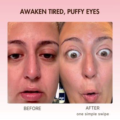 BOGO - Korean Retinol Under Eye Balm