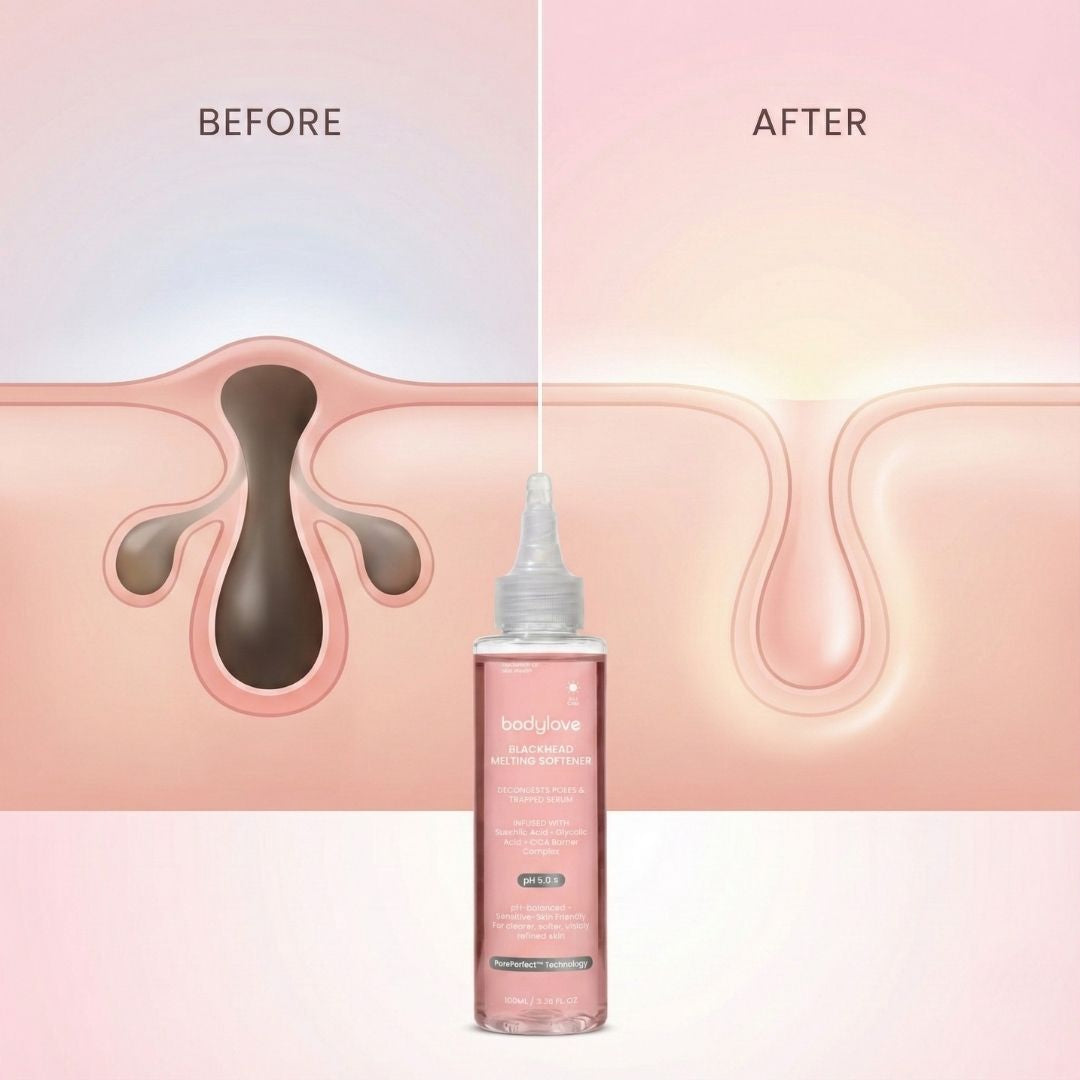 Blackhead Melting Softner