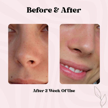 Clear Pore Patch