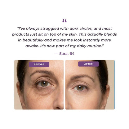 EyeCorrect+ Undereye Brightener