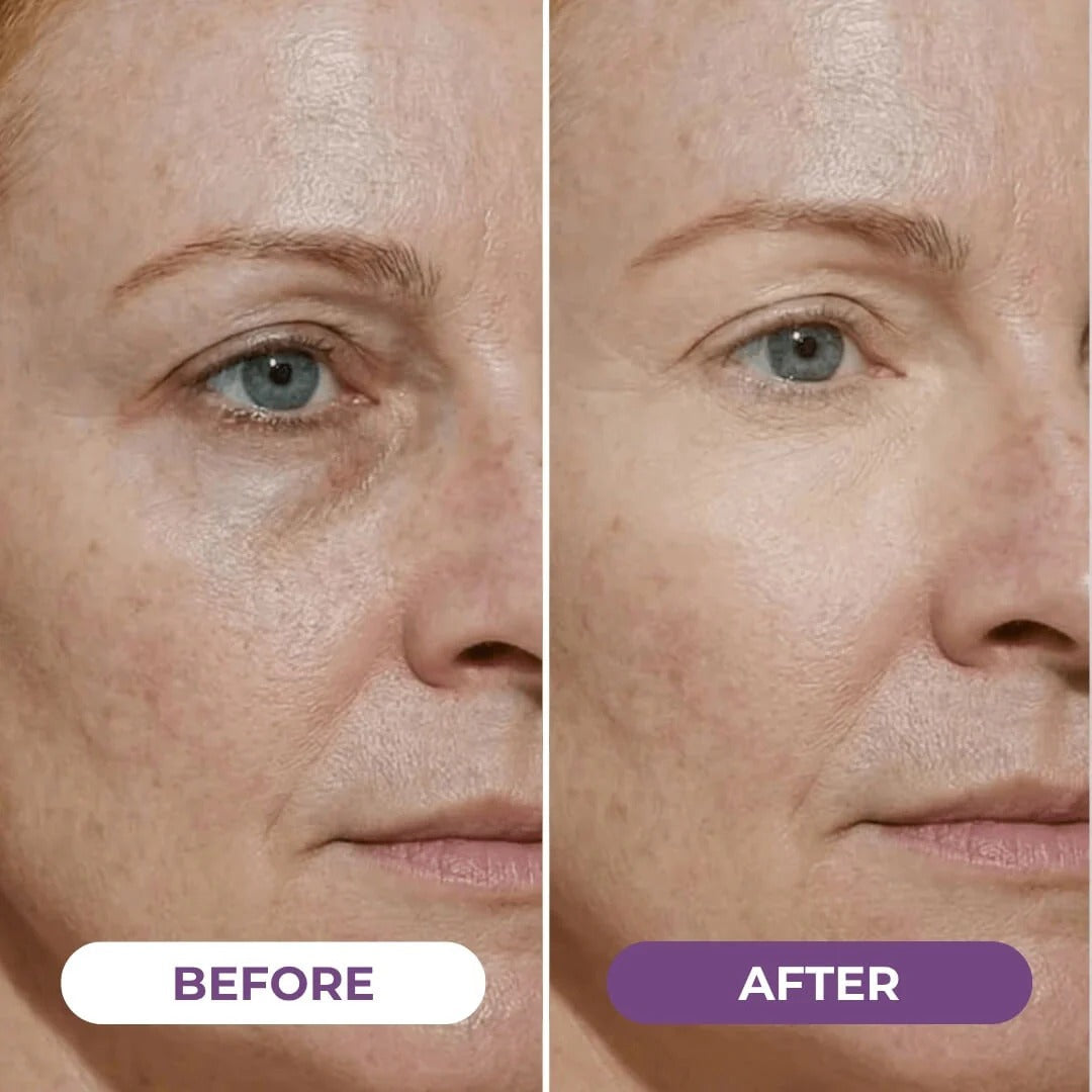 EyeCorrect+ Undereye Brightener